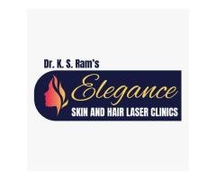 Laser Hair Removal Service In Secunderabad