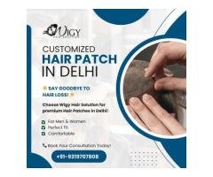 Customized Hair Patch in Delhi Wigy Hair Solution