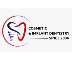 Dentacare - Best Dental Clinic in Bilekahalli