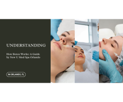 How Botox Works A Guide by New U Med Spa Orlando