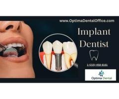 Trusted Implant Dentist in Bristol Delivering Confident Smiles with Precision