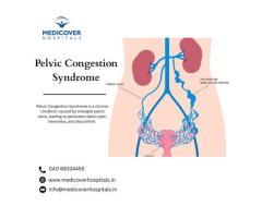 Pelvic Congestion Syndrome Medicover Hospitals