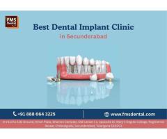 Best Dental Implant Clinic in Secunderabad - FMS Dental
