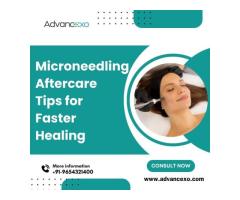Microneedling Aftercare Tips for Faster Healing Advancexo