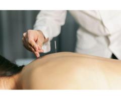 Addiction Acupuncture in New York Natural Healing Support