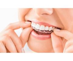 Experience Expert Care at the Best Dental Clinic in Delhi