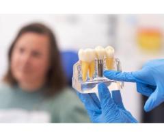 Advanced Dental Implant Treatment in Paschim Vihar