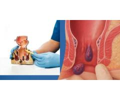 Experienced Doctors for Fissure Treatment in Delhi
