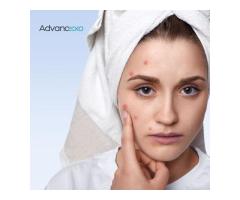 Best Treatment for Pigmentation on Face Advancexo
