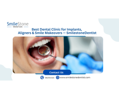 Best Smile design in Nagpur