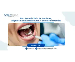 Best Smile design in Nagpur