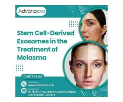 Stem Cell-Derived Exosomes in the Treatment of Melasma