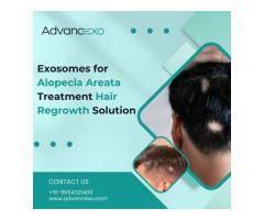 Exosomes for Alopecia Areata Treatment Hair Regrowth Solution
