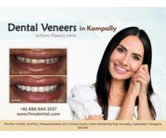 Dental Veneers in Kompally - FMS Dental