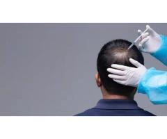 Consult the Best Dermatologist for Hair Loss in Shalimar Bagh