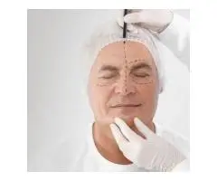 Rinoplastica Naso Prezzo