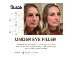 Professional under Eye Filler in Newport Beach