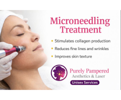 Microneedling Treatments Surrey BC Book Now