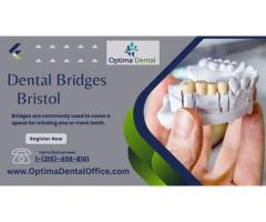 Dental Bridges Bristol Reliable Tooth Replacement Solutions at Optima Dental Office