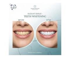 Permanent Dental Implants in Delhi Bhasin Dental Clinic