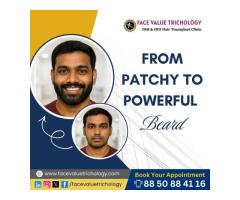 Advanced Hair Treatment Clinic in Chennai