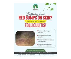 Kalpataru Ayurvediya Chikitsalaya Ayurvedic Doctor In Pune