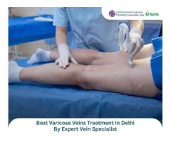 Advanced Non-Surgical Varicose Veins & Fibroid Treatment in Delhi Dr. Pradeep Muley