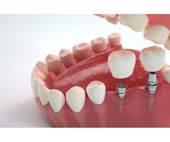 Dental Implants in Northeast Philadelphia for Long Lasting Natural Looking Smiles