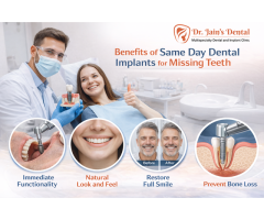 Best Implant Dentist In Noida