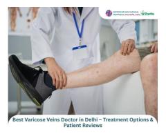 Varicose Veins and Fibroid Treatment in Delhi Expert Care - 4