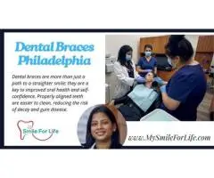 Modern Braces Philadelphia Services Designed for Beautiful Healthy Smiles