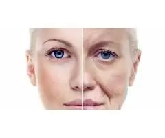 Anti Ageing Facials in Surrey Smooth, Youthful Skin Book Now
