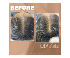 Mahi Skin, Hair and Laser Clinic, Sowcarpet - 5