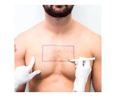 Hair Specialist Doctor in Hanamkonda