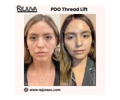 PDO Thread Lift Newport Beach