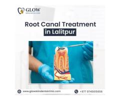 Root Canal Treatment in Lalitpur