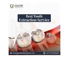 Best Tooth Extraction Service in Kathmandu