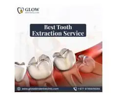 Best Tooth Extraction Service in Kathmandu