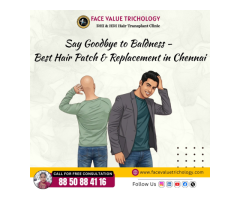 Best Hair Patch & Hair Replacement Treatment in Chennai Non-Surgical Hair Solution