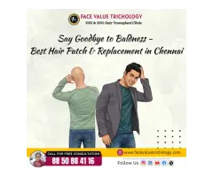 Best Hair Patch & Hair Replacement Treatment in Chennai Non-Surgical Hair Solution