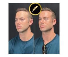 Aesthetic & Cosmetic Surgeon in Los Angeles Dr. Saurabh Jain