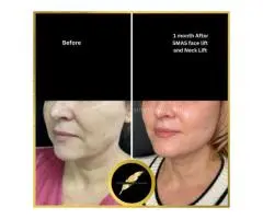 Aesthetic & Cosmetic Surgeon in Los Angeles Dr. Saurabh Jain - 2