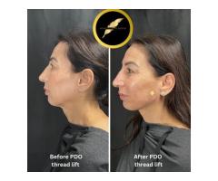 Aesthetic & Cosmetic Surgeon in Los Angeles Dr. Saurabh Jain - 4