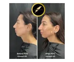 Aesthetic & Cosmetic Surgeon in Los Angeles Dr. Saurabh Jain - 4