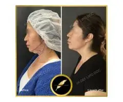 Aesthetic & Cosmetic Surgeon in Los Angeles Dr. Saurabh Jain - 7