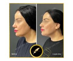 Aesthetic & Cosmetic Surgeon in Los Angeles Dr. Saurabh Jain - 8