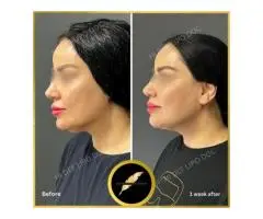Aesthetic & Cosmetic Surgeon in Los Angeles Dr. Saurabh Jain - 8
