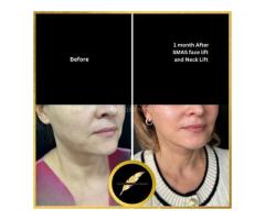 Aesthetic & Cosmetic Surgeon in Los Angeles Dr. Saurabh Jain - 9