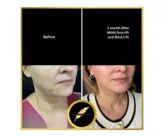 Aesthetic & Cosmetic Surgeon in Los Angeles Dr. Saurabh Jain - 9