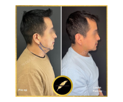 Aesthetic & Cosmetic Surgeon in Los Angeles Dr. Saurabh Jain - 10